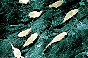 Microscopy Prints: Collagen. Fibroplasts on external surface of intestine ESM (Electron Scanning Microscope)
