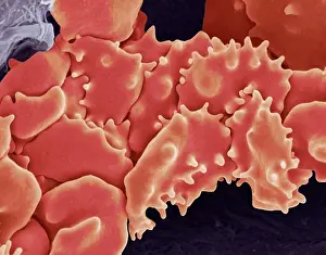 Electron Prints: Crenated red blood cells, SEM