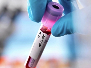 Differential Prints: Cropped view of doctor holding vial of blood