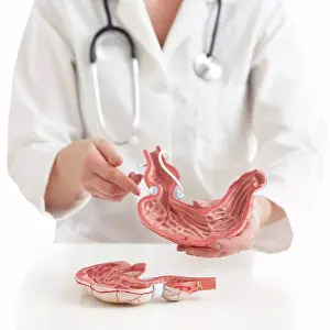 Medical Procedure Prints: Doctor with model of stomach with gastric band