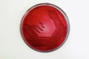 Disease Prints: E-coli (Escherichia coli O157:H7) sample taken from swab