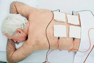 Spine Prints: Electrotherapy physiotherapy treatment