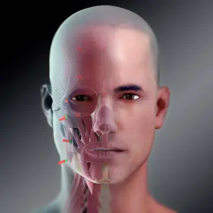Facial Reconstruction