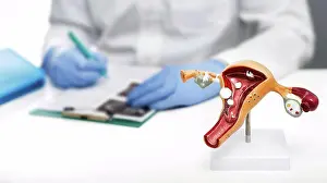 Examination Prints: Female reproductive disorders, conceptual image