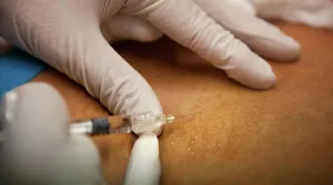 Woman Patient Prints: General practitioner practicing mesotherapy and injecting hyaluronic acid into a patient