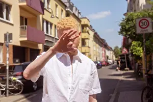 Disability Prints: Germany, Cologne, Albino man in white shirt on street