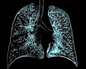 X Ray Prints: Healthy lungs, 3D CT scan