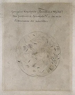 Vincent Prints: Hospital gangrene, fusiform bacillus and spirochetes. Drawing by H. Vincent