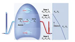 Respiratory System Prints: Illustration of the 3 lung zones defined by alveolar pressure