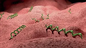 Disease Prints: Illustration of a syphilis infection