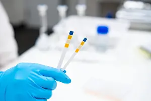 Analysis Prints: Making a pH test of water in the chemical laboratory