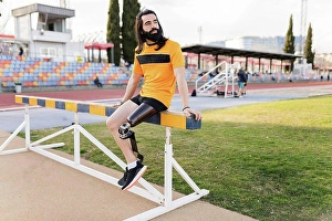 Handicapped Prints: Man with prosthetic leg sitting on hurdle