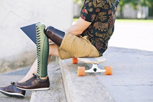 Handicapped Prints: Man with prosthetic leg using laptop on steps