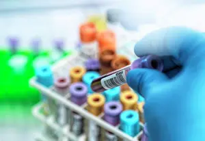 Baby Boomer Prints: Medical technician preparing human samples for medical testing in lab