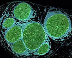 Stained Prints: Nerve fibres. Light micrograph (LM) of a transverse section through a bundle (fascicle) of nerve fibres