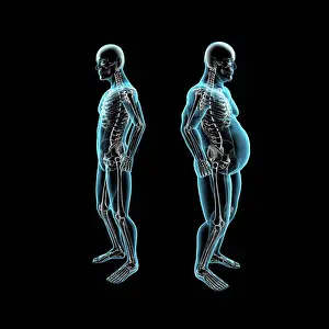 Heavy Prints: Thin and obese men back to back, X-ray image
