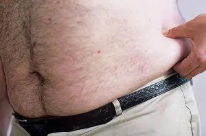 Overweight Prints: Obesity