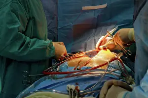Nahaufnahme Prints: operation, kardiologie, chirurgie