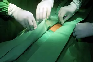 Sudan Prints: Patient is being prepared for surgical removal of