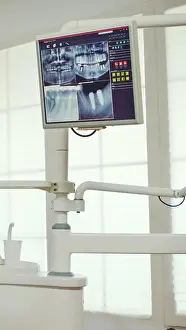 Examination Prints: Pediatric dentist showing on monitor teeth x-ray
