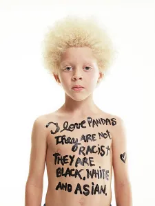 Activism Prints: Portrait of Albino boy with words painted on body I love pandas