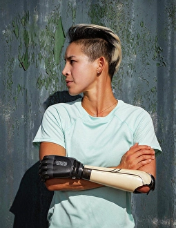 Disability Prints: Portrait of athlete woman with prosthetic arm