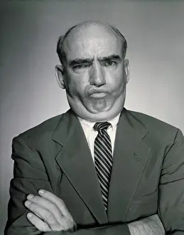 Bald Prints: Portrait of mature man making face