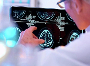 Gifted Prints: Radiologist assessing CT brain scan