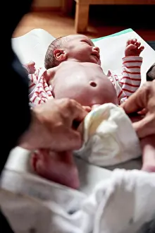 Examination Prints: Reportage on a midwife in Lyon, France. Examining a 2-week old babys hips and pelvis