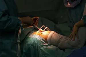 Surgery Prints: Reportage in the orthopedic surgery service in Saint George Clinic
