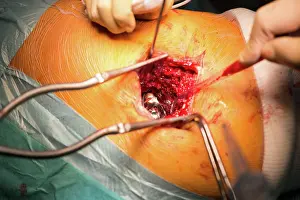 Surgery Prints: Reportage in the orthopedic surgery service in Saint George Clinic