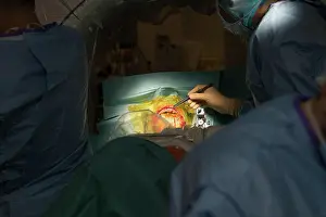 Woman Patient Prints: Reportage in the stereotactic neurosurgery operating theatre in Pasteur 2 Hospital