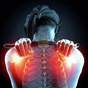 Disorder Prints: Shoulder pain, computer artwork