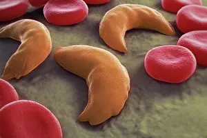 Science Faction Prints: Sickle-cell disease