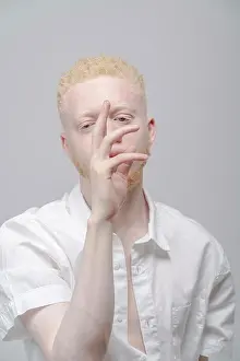 Diverse Prints: Studio portrait of albino man in white shirt