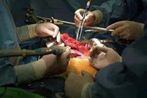 South Korea Prints: Surgeons performing liver transplant