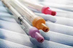 Medical Prints: Three syringes - monovette tube