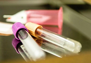 Test Tube Prints: Test tubes
