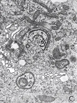 Disease Prints: This transmission electron micrograph (TEM) revealed the presence of a number of Eastern Equine Encephalitis (EEE)