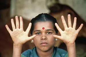 Expressions Prints: woman with six fingers to hand, india