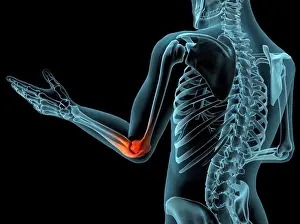 Spinal Prints: X-ray view of elbow joint with red inflammation in a see-through arm with hand and spinal bones